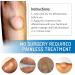 Lipoma Removal Cream 20g - Natural Treatment for Lipoma Care & Discomfort - Buy Online on GoSupps.com