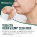 TreeActiv Rough & Bumpy Skin Lotion - Hyaluronic Acid Shea Butter & Vitamin E | 8 fl oz Moisturizer for Strawberry Legs & All Skin Types - Buy Online on GoSupps.com