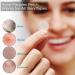 VonTeok Acne Pimple Patches (144 Patches) Ultra-Thin Hydrocolloid Stickers with Tea Tree Oil for Fast Redness Relief & Concealment of Zits Blemishes Spots - Buy Online on GoSupps.com