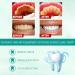 Ultra-Fine Saveuppro Teeth Whitening Mousse Toothpaste | Deep Clean & Intensive Stain Removal Foam - Buy Online on GoSupps.com