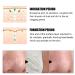 2PCS Nose Pore Strips - Blackhead Remover & Deep Cleansing Peel Off Strips for All Skin Types - Buy Online on GoSupps.com