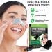 Nose Strips 20 Pcs for Blackheads - Deep Cleansing Pore Strips for Men & Women - Blackhead Remover - Buy Online on GoSupps.com