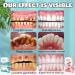 Oralheal Jelly Cup Mouthwash - Restore Oral Health & Combat Bad Breath | 3 Boxes | Fivfivgo - Buy Online on GoSupps.com