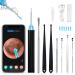 PAIRIER Ear Wax Removal Kit Camera 1080P Visual Ear Cleaner Upgraded Otoscope Earwax Removal Kit with 6 Lights and 7 PCS Ear Set for iPhone ipad Android/Adults Kids Pets