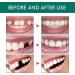 LDADGF Plastic Tooth Adhesive - Perfect Temporary Filling for Broken Teeth | Dental Adhesive for Oral Use (One Size White) - Buy Online on GoSupps.com