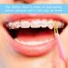 Buy 300PCs Dental Orthodontic Latex Elastics | Elastic Braces Gum & Toothed Gum Pull Tapes | High-Quality Rubber Bands for Orthodontics - Buy Online on GoSupps.com