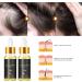 2024 New Folix 22 Hair Growth S rum de croissance des cheveux formule de croissance des cheveux huile de croissance des cheveux biotine s rum paississant base d'herbes huile de croissance des 3 pi ces - Buy Online on GoSupps.com