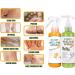 Foot Peeling Spray Orange Oil Exfoliating Foot Moisturizing Hydrating Nourish Peel Off Spray Remove Dead Skin And Calluses On Feet Gentle Foot Care. (Green Tea) - Buy Online on GoSupps.com