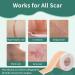 Medical Grade Silicone Scar Sheets (1.57 x 60) - Effective Scar Removal Strips for Acne & Burn Scars - Buy Online on GoSupps.com