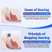 Anti Snoring Devices - Effective Snoring Solution for Men & Women | Adjustable Breathable & Suitable for All Nose Shapes - Blue/Black - Buy Online on GoSupps.com