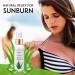 Aloe Vera Spray for Hair Dreads & Locs + Eucalyptus Face Mist | Hydrating & Refreshing 2oz - Buy Online on GoSupps.com
