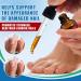 Traitement des Mycoses des Ongles 30ml - Soin Intensif l'Acide Und cyl nique 25% & Huiles Essentielles - R pare et Renforce les Ongles paissis Jaunis et Ab m s - Buy Online on GoSupps.com