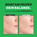Troubless Mild Clear Toner Essence - Hydrating & Soothing Tea Tree Facial Toner for All Skin Types | Moisturizing Daily Skin Care (6.76 fl oz - Buy Online on GoSupps.com