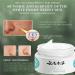LELEBEAR Japanese Melasma Cream - Skin Care Set for White Spot, Freckles, and Moisturization, Made in Japan by Dr. Hancy - 3PCS - Buy Online on GoSupps.com