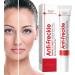Freckle Remover For The Face Correcting Skin Imperfections Relieving & Repairing Face Cream for Skin Care Body and Women - Buy Online on GoSupps.com