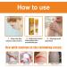 UPiKIT Bee Venom Psoriasis Treatment Cream - 20g/pc (3pcs) - For All Skin Types - Buy Online on GoSupps.com
