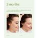 Divi Scalp Serum: Revitalize, Detoxify & Combat Hair-Thinning | Nourishing Formula for Hair Follicles | Detoxifies Product Build-Up - Buy Online on GoSupps.com