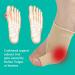 Bunion Corrector for Women & Men | Hallux Valgus Pain Relief Sleeves & Pads | Orthopedic Big Toe Straightener & Protector - Buy Online on GoSupps.com