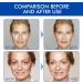 Boto Stock Solution Facial Serum - Boto-x Stock Anti Aging Serum For Face - Instant Face Tightening Boto Reduce Fine Lines Wrinkles Boost Skin Collagen Hydrate & Plump Skin 30ml - Buy Online on GoSupps.com