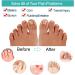 Sumiwish 16 PCs Gel Bunion Correctors & Toe Separators - Relieve Bunions Overlapping Toes & Foot Pain - Buy Online on GoSupps.com