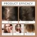 3in1 nourishing conditioning shampoo hair growth shampoo with rosemary batana Onion for men and women reduces hair loss 1 piece - Buy Online on GoSupps.com
