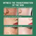 Dark Spot Remover for Face Body Dark Spot Corrector Age Spot Remover for Face Spot Cream with Niacinamide Vitamin C Reduces Hyperpigmentation Sun Spot Remover Blemish Freckle Reducer - Buy Online on GoSupps.com