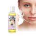 Yellow Peeling Oil Chemical Peel Peeling Oil for Dark Skin Strong Peeling Oil Extra Strength Exfoliating Peeling Solution for Body All Skin Type 1 Bottle Yellow Peeling Oil