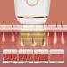 Pothit 5 Light Intensity Laser Hair Removal | Mild & Painless for Men - Face Legs Armpits & Bikini Zones - Buy Online on GoSupps.com