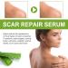 Goopgen Advanced Scar Repair Serum - Medical Grade Treatment for All Types of Scars (3PC) - Buy Online on GoSupps.com