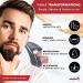 Derma Roller INFINITIVE BEAUTY 540 Titanium Alloy Microneedle Roller for Skin Face Beard & Hair (0.75mm) - Buy Online on GoSupps.com