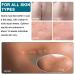 Silicone Scar Treatment Rollers - Heal C-Section Burns Keloids & Acne | 4cm x 320cm | Free Shipping Worldwide - Buy Online on GoSupps.com