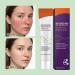Gel Hydratant Visage | Soin Gel Visage Anti-Imperfections Non Collant | Soin Traitant pour le Corps Pour Voyage d'Affaires Maison Ext rieur cole Hommes Femmes  - Buy Online on GoSupps.com