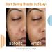 Acne Free 3 Step Treatment Kit - Oil Free Cleanser Witch Hazel Toner & Lotion | Effective Acne Solution with Benzoyl Peroxide for Teens & Adults - Buy Online on GoSupps.com