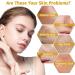 Niacinamide Face Serum 10% Niacinamide Serum + 1% Zinc Serum Face Moisturiser High Strength Vitamin Nourish Skincare Anti Aging Dark Spot Remover for Face Glow Skin Correcting (30ML) - Buy Online on GoSupps.com