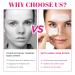 Buy T-Zone Blackhead Strips | 30 Nose Strips & 60 Facial Blackhead Removers | Remove Blackheads & Impurities - Fast International Shipping! - Buy Online on GoSupps.com