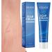 Aibyks Anti-Scars Cream - Healing Gel for Burns - 0.5 FL.Oz Scar Gel for Keloids and Hypertrophic Scars Reduces the Appearance of Bruises Moisturizing Gel - Buy Online on GoSupps.com