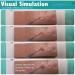 Intradermal Injection Practice Simulator Intramuscular Training IV Pad Model2022 - Buy Online on GoSupps.com