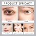 Nicotinamide Eye Cream for Dark Circles Anti-Aging Moisturizing Treatment for Under Eye Area Fight Fine Lines Wrinkles & Dark Spots 0.53 oz - Buy Online on GoSupps.com