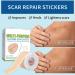 Medical Grade Silicone Scar Sheets - 1.6 x 60 inches - C-Section, Keloids, Tummy Tuck - Reduce Scarring and Promote Healing - Buy Online on GoSupps.com