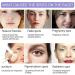 Dark Spot Remover for Face Spot Cream Dark Spot Corrector Skin Lightening Cream Pigmentation Removal Cream Dark Spot Correcting Glow Serum for Melasma Freckle Sun Spot Remover Blemish Reduction - Buy Online on GoSupps.com