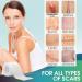 Silicone Scar Sheets Roll - 1.6 x 120 - 3M Clear Scar Tape for Scars Removal - Reusable Strips for Keloid, C-Section, Surgery, Burn, Acne - Elastic Bandage Treatment - Buy Online on GoSupps.com
