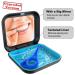 Invisalign Aligner Case with Mirror and Removal Tool - Premium Retainer Case for Mouth Guards - Easy to Use (Black) - Buy Online on GoSupps.com