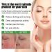Antifungal Cream:Jock Itch Cream Soothing Eczema Relief Cream All-Natural Soothing Care & Fast Relief of Jock Itch Eczema Psoriasis - Ringworm Treatment for Humans - for Adults and Kids - Buy Online on GoSupps.com