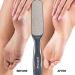 Probelle Double Sided Multidirectional Nickel Foot File Callus Remover - Instantly Reduce Calluses and Corns to Powder, Safe Tool (Dark Grey) - Buy Online on GoSupps.com