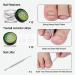 Ingrown Toenail Treatment Kit | Toe Nail Correction Tool Set with Tweezers and Nail File Lifter | Pedicure Tool for Ingrown Toenails - Buy Online on GoSupps.com