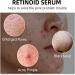 AHA 30%+BHA 2% Face Serum Skincare Serum AHA Serum for Hydrated Hydrating Serum BHA Serum for Smooth Skin Exfoliating Brightening Serum for Face Peeling Solution Anti Aging Serum for Face Fine Line - Buy Online on GoSupps.com