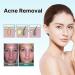 CRusio Awzlove Ampoule Scar Removal Serum - Remove New Scars in 3 Weeks, Old Scars in 6 Weeks (1pcs) - Buy Online on GoSupps.com