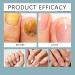 Huile de soin des ongles 3 jours la k ratine et aux acides amin s fortifiante pour ongles fragiles et ab m s huile pour cuticules et ong/les de pieds huiles de croissance quotidienne. (4PCS) - Buy Online on GoSupps.com