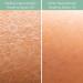 Rice Bran Beauty Healing Body Oil - Vegan Skin Moisturizer & Rejuvenator (8 oz) - Shop Internationally - Buy Online on GoSupps.com
