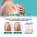 HYOIIO Scar Remove Advanced Spray - Treatment for Acne Scars, Dark Spots, Gentle Skincare for Acne Prone Skin - Buy Online on GoSupps.com
